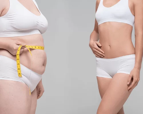 Déroulement de la lipoaspiration