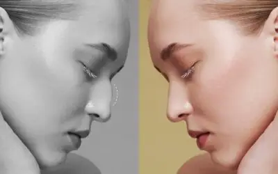 La rhinoplastie ultrasonique : est-ce l’avenir de la chirurgie du nez ?
