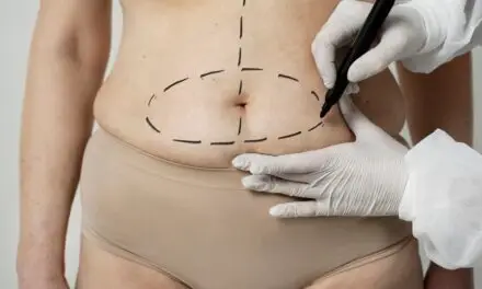 Plastie abdominale ou liposuccion : quelle est la meilleure option pour vous ?